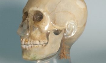 Anthropomorphic X-Ray Phantoms