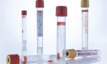 Vacuette CAT Serum Fast Tube