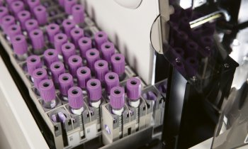 Early Sepsis Indicator