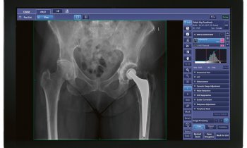 CXDI Control Software NE