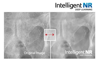 Intelligent Noise Reduction