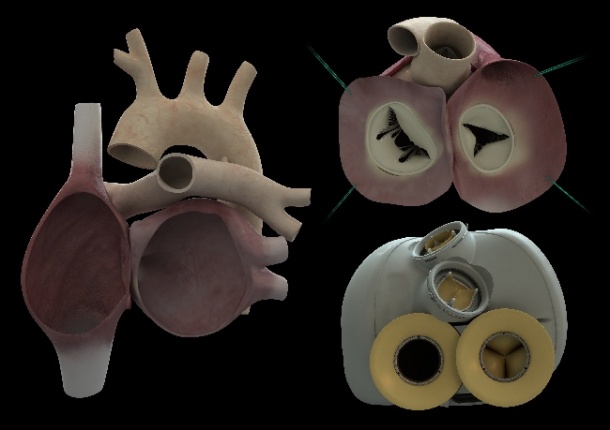 Parts of the new heart device