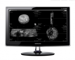 Photo: Breast ultrasound within seconds