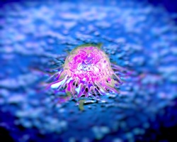 Prostate cancer cells.