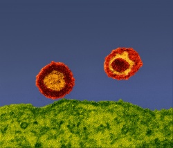 Two HI-Viruses outside the cell (green).
Two HI-Viruses outside the cell...