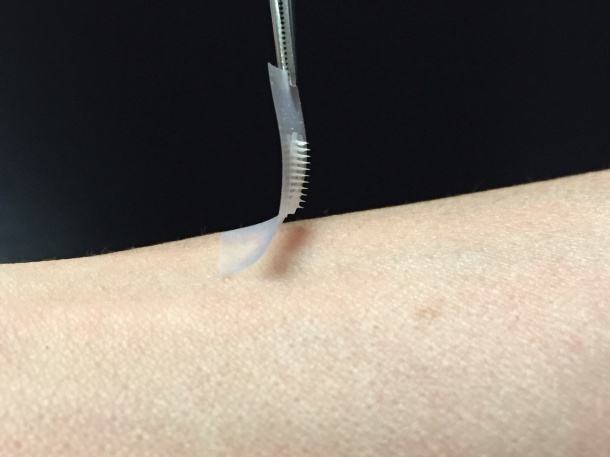 The smart insulin patch could be placed anywhere on the body to detect...