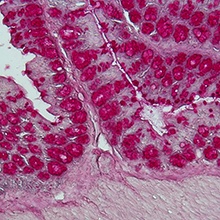 The intestinal microbiota (shown here is a histological staining of a colon...