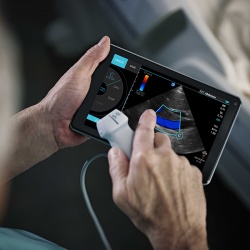 Sonosite iViz is a highly portable ultrasound augmented with mobile computing...