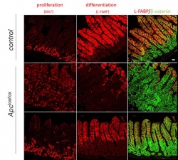 This is a photograph of staining data showing the effects of retinoids on...