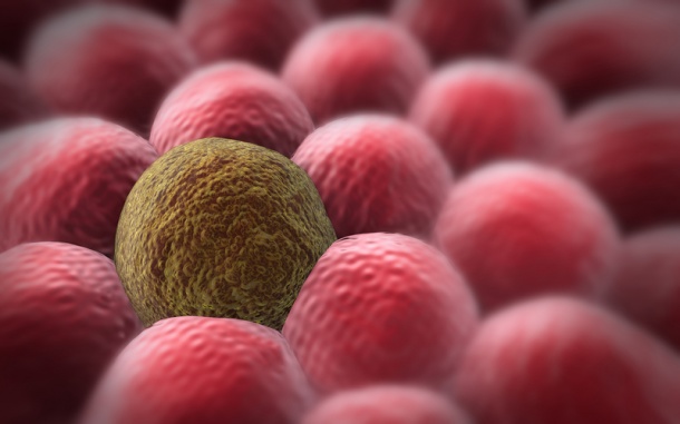 Photo: Stopping tumour cells killing surrounding tissue