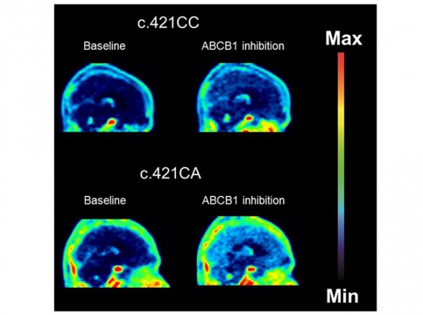 Brain distribution of a dual ABCB1/ABCG2 substrate in a person without (top...