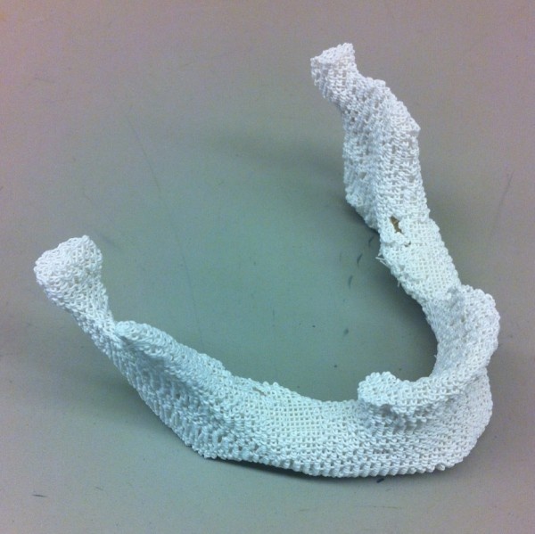 A sample 3D printed scaffold that matches the lower jaw of a female patient.