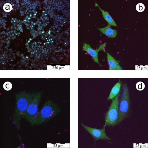These are confocal fluorescence microscopy images of CF2Th cancer cells...