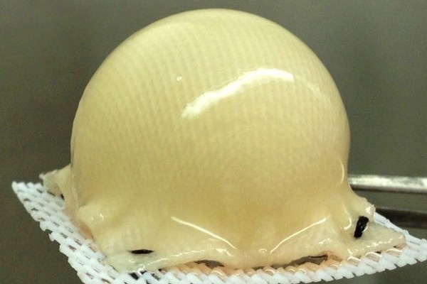A 3-D, biodegradable, synthetic scaffold has been molded into the precise shape...