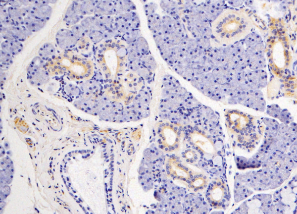 In this lab stain, the small orange-spotted cell on the far left shows a nerve...