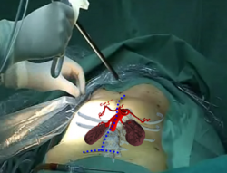 Photo: Augmented Reality visor to dramatically improve surgery