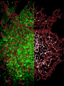 On the left, stained red blood vessels weave between florescent green tumor...