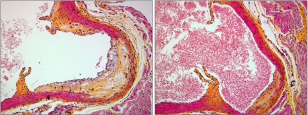 Two images showing a cross section of a mouse aortic blood vessel: the control...