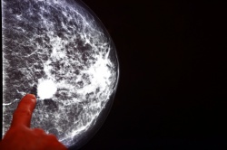 Combined with Mammography, a new breath test could raise the effectiveness of...