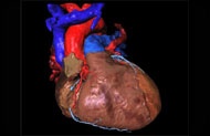 Photo: Computerised model of the heart to develop new therapies