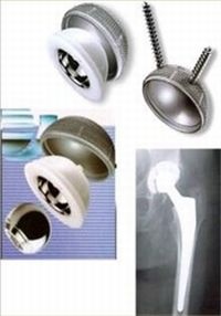 Hip resurfacing devices: unlike total hip replacement the technique does not...