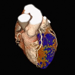 Photo: Toshiba presents advances in Cardiac Imaging at ESC 2012