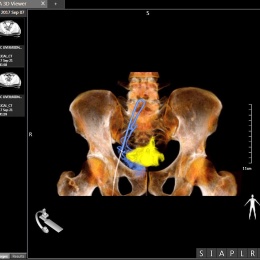 Canon Medical’s 4D CT allows the immediate use of three-dimensional CT images...