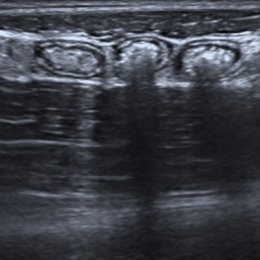 Vorteil Ultraschall: vor allem bei schlanken Patienten ist die Bildauflösung...