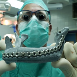 3D surgical Hub in Tel-Aviv medical centre. A plate bent on a Patient Specific...