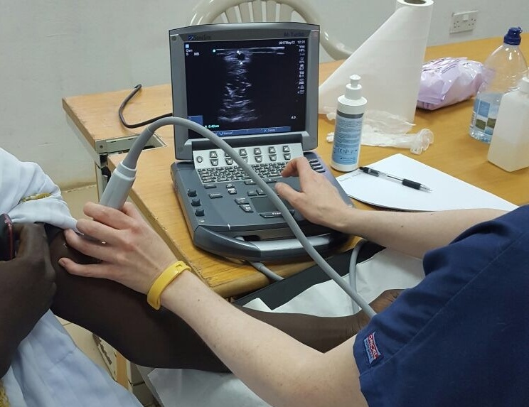 Ultrasound mapping