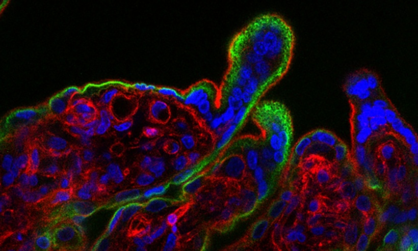 When human placental tissue (fluorescence microscopy image shown) is exposed to...