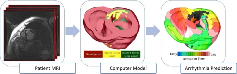 The virtual heart arrhythmia risk predictor. Patient-specific heart models are...