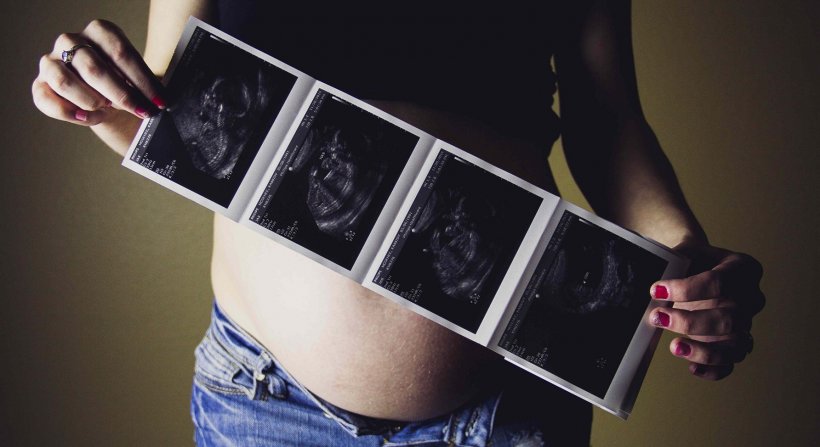 pregnant woman holding sonograpgy photos in her hands