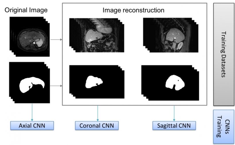 Using combined information of transversal, sagittal or coronal images to...