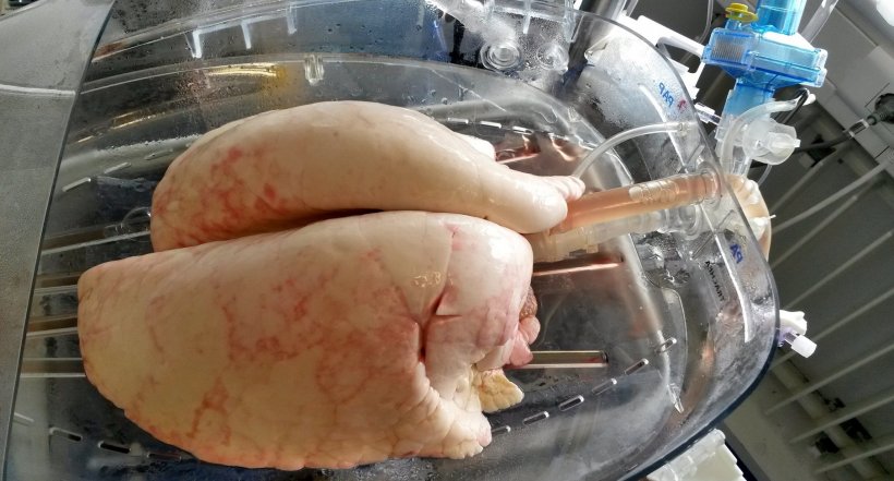 Lungs (from Minipig) in an ex vivo perfusion device after successful genetic...
