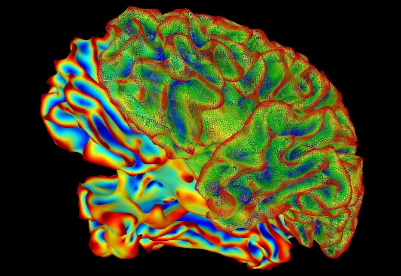 A multi-color image of the human brain.