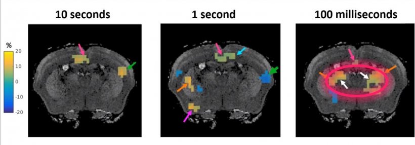 Faster than fMRI: Seeing brain activity in ‘almost real time’