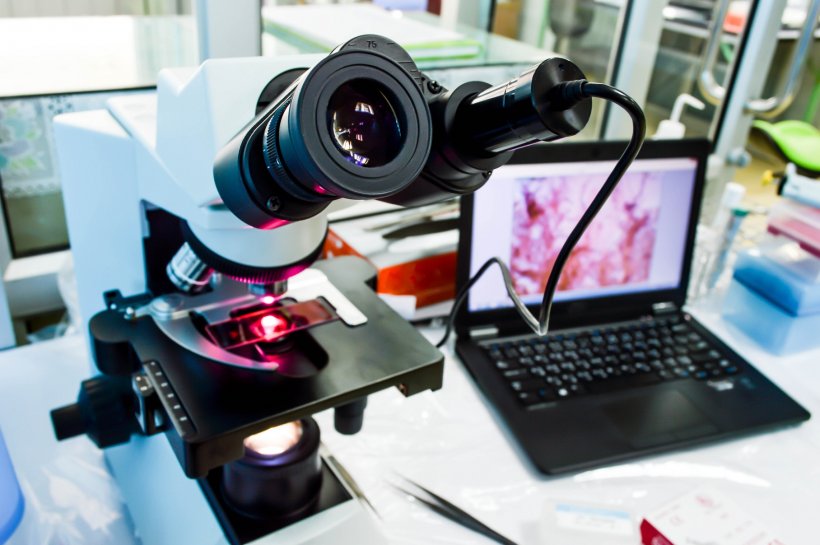 microscope connected to laptop with digital pathology slide