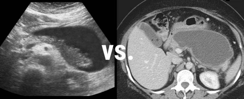 CT and ultrasound images