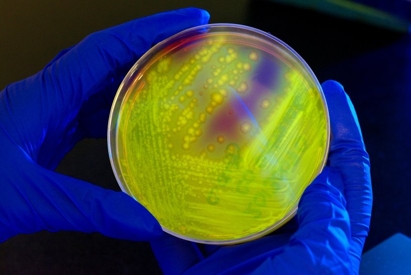 Petri dish inoculated with Clostridium difficile bacterial culture under UV...