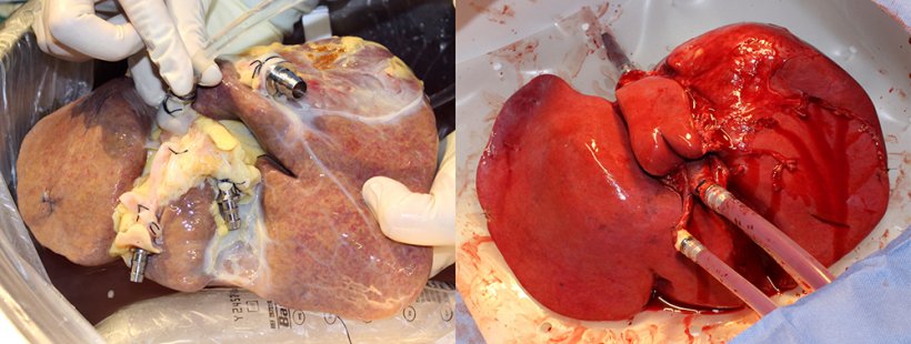 On the left a non-perfused liver, on the right a liver treated with the new...