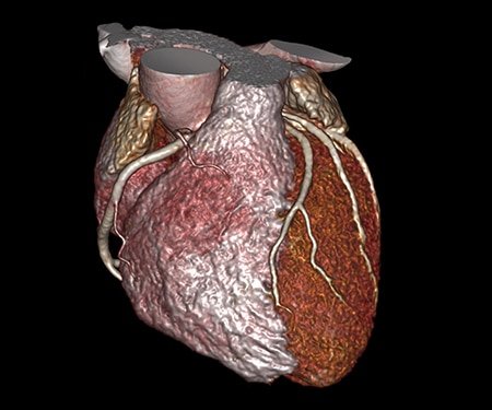 Example: Cardiovascular Imaging