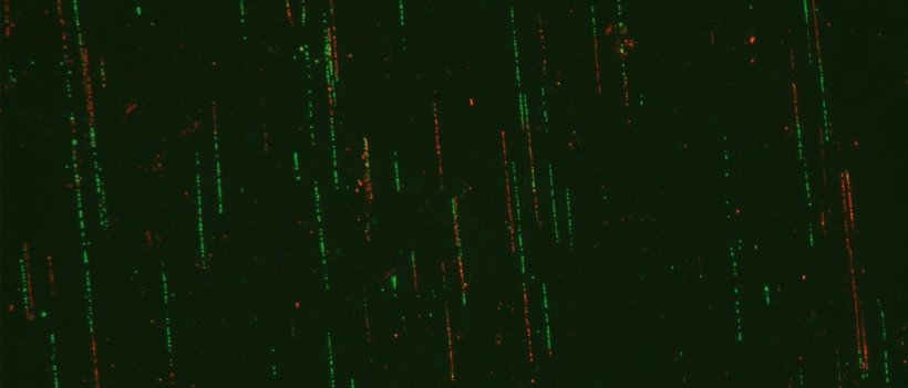 Fluorescence microscopy image showing DNA fibres of Fanconi anemia cells. Green...