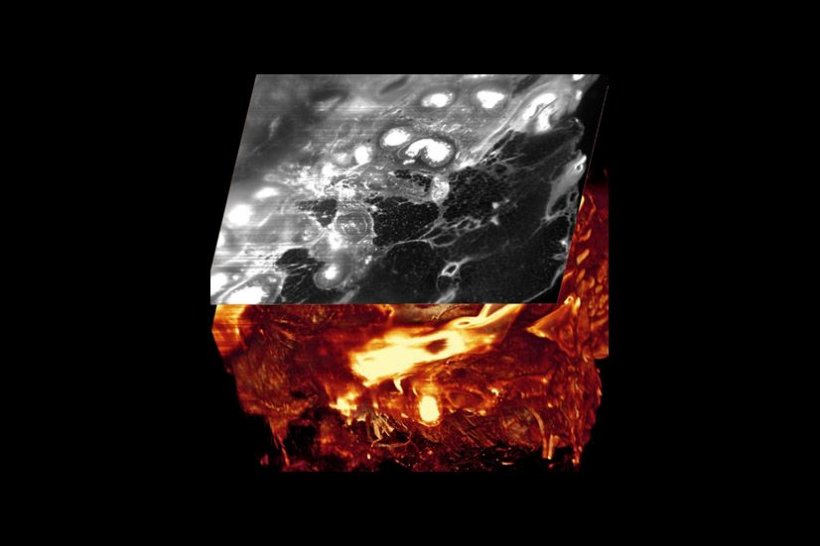 Ultramikroskopie zeigt ganze Tumorstücke in 3D