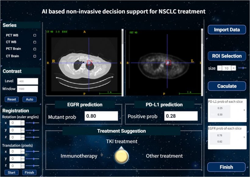 The graphical user interface of the AI based non-invasive treatment decision...