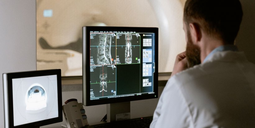 Radiologists looking at CT scans of a patient (symbolic photo)
