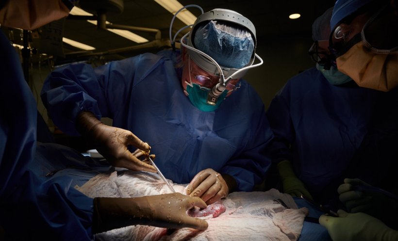 surgeon during organ transplantation procedure in operating room