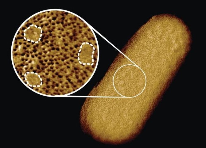 Microscopy image of a living E. coli bacterium, revealing the patchy nature of...