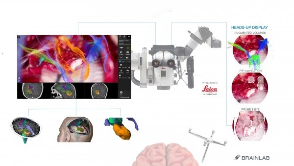 Mount Sinai Neurosurgeon First to Use Microscope Imaging System That Integrates...