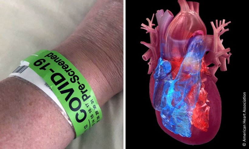 Covid-19 ER wristband and illustration of the hearts chambers